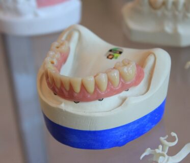 Fixed Dentures